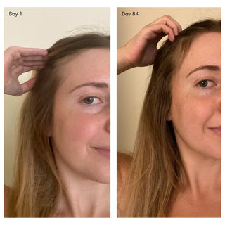 holi (growth) 84 advanced leave-in scalp and hair treatment