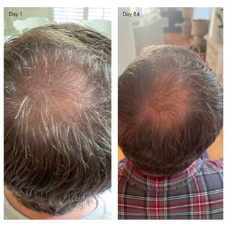 holi (growth) 84 advanced leave-in scalp and hair treatment