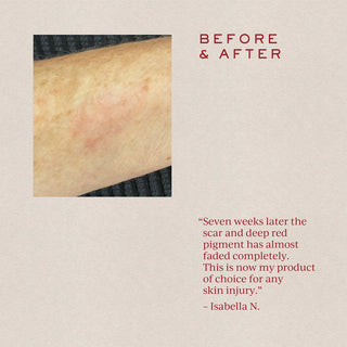 SOFT FOCUS Scar Concentrate