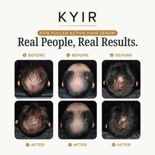 Kyir FULLER Active Hair Serum