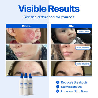 Antimicrobial Skin Spray - 236ml